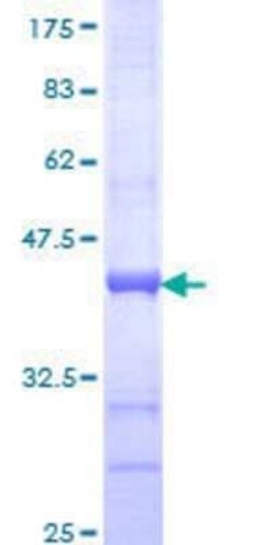 Novus Biologicals Recombinant Human GAS2 GST (N-Term) Protein 10 &mu;g | Buy Online | Novus Biologicals&trade; | Fisher Scientific