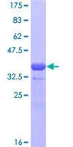 Novus Biologicals Recombinant Human GATA-4 GST (N-Term) Protein 10 &mu;g | Buy Online | Novus Biologicals&trade; | Fisher Scientific