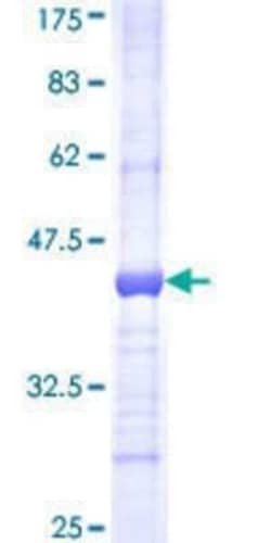 Novus Biologicals Recombinant Human GBE1 GST (N-Term) Protein 25 &mu;g | Buy Online | Novus Biologicals&trade; | Fisher Scientific