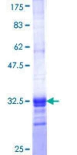 Novus Biologicals Recombinant Human GBP3 GST (N-Term) Protein 10 &mu;g | Buy Online | Novus Biologicals&trade; | Fisher Scientific