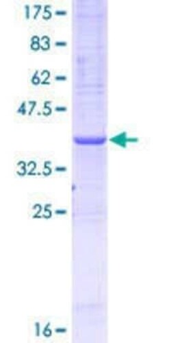 Novus Biologicals Recombinant Human GCH1 GST (N-Term) Protein 10 &mu;g | Buy Online | Novus Biologicals&trade; | Fisher Scientific