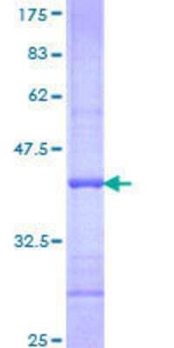 Novus Biologicals Recombinant Human GCNF/NR6A1 GST (N-Term) Protein 25 &mu;g | Buy Online | Novus Biologicals&trade; | Fisher Scientific