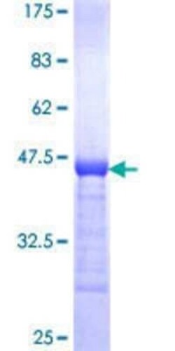 Novus Biologicals Recombinant Human GGCX GST (N-Term) Protein 2 &mu;g | Buy Online | Novus Biologicals&trade; | Fisher Scientific