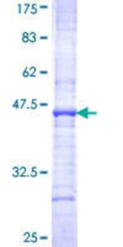 Novus Biologicals Recombinant Human GHRHR GST (N-Term) Protein 10 &mu;g | Buy Online | Novus Biologicals&trade; | Fisher Scientific
