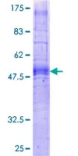 Novus Biologicals Recombinant Human Ghrelin Receptor/GHSR GST (N-Term) Protein 25 &mu;g | Buy Online | Novus Biologicals&trade; | Fisher Scientific