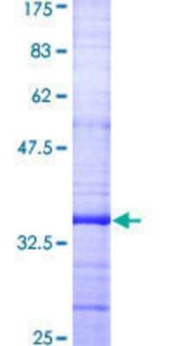 Novus Biologicals Recombinant Human Connexin 32/GJB1 GST (N-Term) Protein 25 &mu;g | Buy Online | Novus Biologicals&trade; | Fisher Scientific