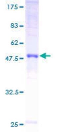 Novus Biologicals Recombinant Human Connexin 30.1/GJB5 GST (N-Term) Protein 10 &mu;g | Buy Online | Novus Biologicals&trade; | Fisher Scientific