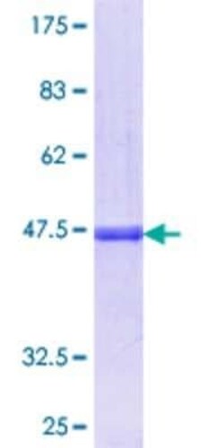 Novus Biologicals Recombinant Human GLI4 GST (N-Term) Protein 25 &mu;g | Buy Online | Novus Biologicals&trade; | Fisher Scientific