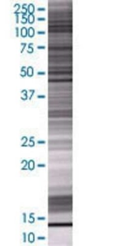 Novus Biologicals GLI4 293T Cell Transient Overexpression Lysate 0.1 mL | Buy Online | Novus Biologicals&trade; | Fisher Scientific