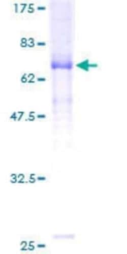 Novus Biologicals Recombinant Human Glycine Receptor alpha 1 + alpha 2 GST (N-Term) Protein 25 &mu;g | Buy Online | Novus Biologicals&trade; | Fisher Scientific