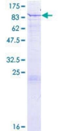 Novus Biologicals Recombinant Human Glutamate Dehydrogenase 2/GLUD2 GST (N-Term) Protein 2 &mu;g | Buy Online | Novus Biologicals&trade; | Fisher Scientific