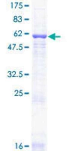 Novus Biologicals Recombinant Human GNB2 GST (N-Term) Protein 10 &mu;g | Buy Online | Novus Biologicals&trade; | Fisher Scientific