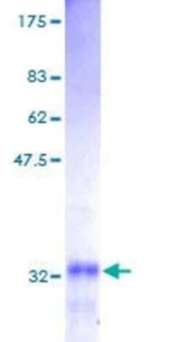 Novus Biologicals Recombinant Human GNG5 GST (N-Term) Protein 2 &mu;g | Buy Online | Novus Biologicals&trade; | Fisher Scientific