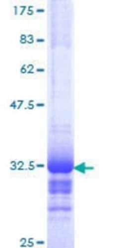 Novus Biologicals Recombinant Human GNG5 GST (N-Term) Protein 10 &mu;g | Buy Online | Novus Biologicals&trade; | Fisher Scientific