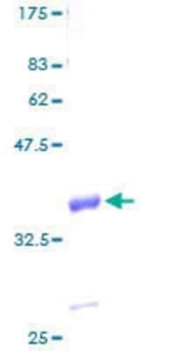 Novus Biologicals Recombinant Human G gamma14 GST (N-Term) Protein 25 &mu;g | Buy Online | Novus Biologicals&trade; | Fisher Scientific