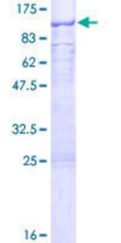 Novus Biologicals Recombinant Human GNL1 GST (N-Term) Protein 25 &mu;g | Buy Online | Novus Biologicals&trade; | Fisher Scientific