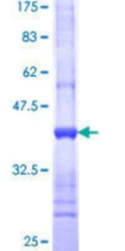 Novus Biologicals Recombinant Human GNL1 GST (N-Term) Protein 10 &mu;g | Buy Online | Novus Biologicals&trade; | Fisher Scientific
