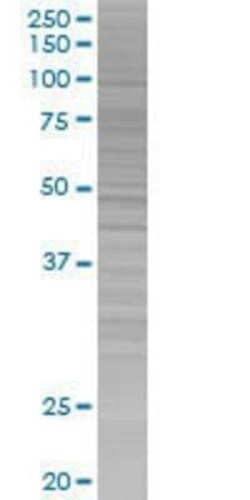 Novus Biologicals GNL1 293T Cell Transient Overexpression Lysate 0.1 mL | Buy Online | Novus Biologicals&trade; | Fisher Scientific