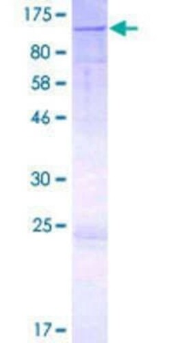 Novus Biologicals Recombinant Human Golgin 97 GST (N-Term) Protein 2 &mu;g | Buy Online | Novus Biologicals&trade; | Fisher Scientific
