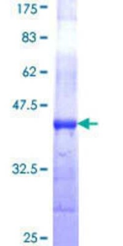 Novus Biologicals Recombinant Human Golgin 97 GST (N-Term) Protein 25 &mu;g | Buy Online | Novus Biologicals&trade; | Fisher Scientific