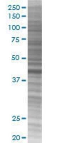 Novus Biologicals GM130/GOLGA2 293T Cell Transient Overexpression Lysate 0.1 mL | Buy Online | Novus Biologicals&trade; | Fisher Scientific