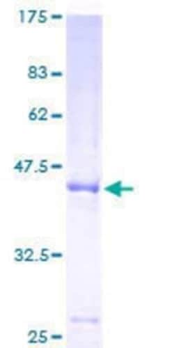 Novus Biologicals Recombinant Human GPI-PLD/GPLD1 GST (N-Term) Protein 10 &mu;g | Buy Online | Novus Biologicals&trade; | Fisher Scientific