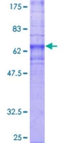 Novus Biologicals Recombinant Human GPR4 GST (N-Term) Protein 25 &mu;g | Buy Online | Novus Biologicals&trade; | Fisher Scientific