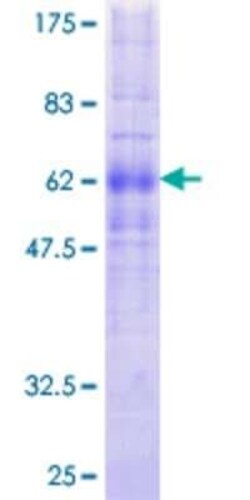 Novus Biologicals Recombinant Human GPR10 GST (N-Term) Protein 25 &mu;g | Buy Online | Novus Biologicals&trade; | Fisher Scientific