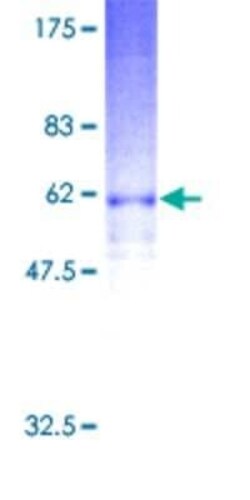 Novus Biologicals Recombinant Human GPR17 GST (N-Term) Protein 2 &mu;g | Buy Online | Novus Biologicals&trade; | Fisher Scientific