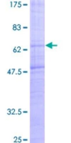 Novus Biologicals Recombinant Human MCHR1 GST (N-Term) Protein 10 &mu;g | Buy Online | Novus Biologicals&trade; | Fisher Scientific