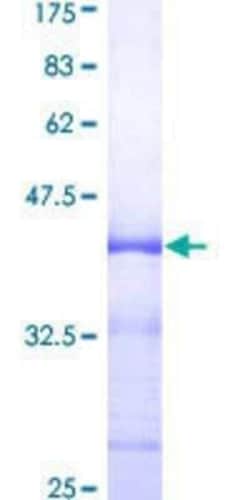 Novus Biologicals Recombinant Human MCHR1 GST (N-Term) Protein 10 &mu;g | Buy Online | Novus Biologicals&trade; | Fisher Scientific