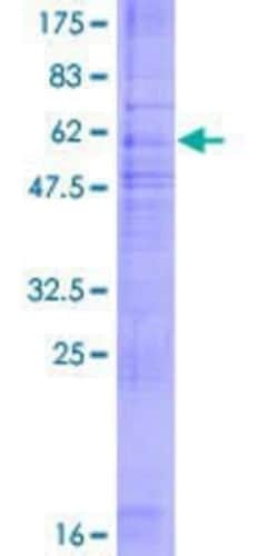 Novus Biologicals Recombinant Human GPER/GPR30 GST (N-Term) Protein 2 &mu;g | Buy Online | Novus Biologicals&trade; | Fisher Scientific