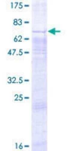 Novus Biologicals Recombinant Human GPR34 GST (N-Term) Protein 2 &mu;g | Buy Online | Novus Biologicals&trade; | Fisher Scientific