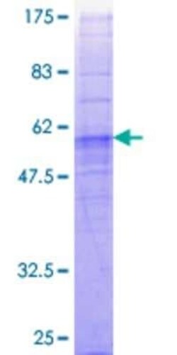 Novus Biologicals Recombinant Human FFAR2/GPR43 GST (N-Term) Protein 2 &mu;g | Buy Online | Novus Biologicals&trade; | Fisher Scientific