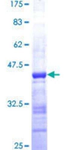 Novus Biologicals Recombinant Human GRK4 GST (N-Term) Protein 25 &mu;g | Buy Online | Novus Biologicals&trade; | Fisher Scientific