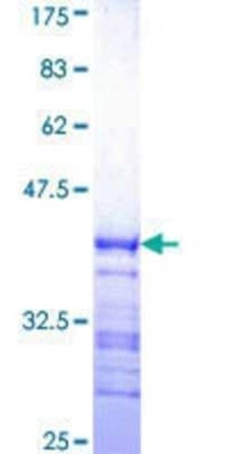 Novus Biologicals Recombinant Human GPS2 GST (N-Term) Protein 10 &mu;g | Buy Online | Novus Biologicals&trade; | Fisher Scientific