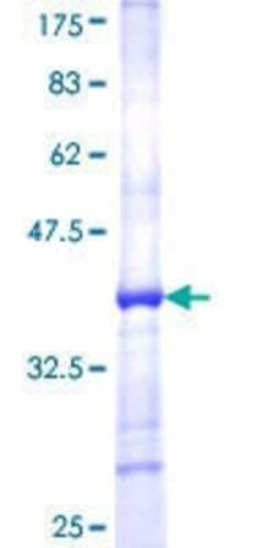 Novus Biologicals Recombinant Human Glutathione Peroxidase 5 GST (N-Term) Protein 10 &mu;g | Buy Online | Novus Biologicals&trade; | Fisher Scientific