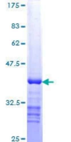 Novus Biologicals Recombinant Human GRB2 GST (N-Term) Protein 10 &mu;g | Buy Online | Novus Biologicals&trade; | Fisher Scientific