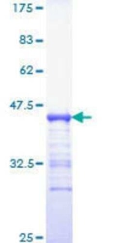 Novus Biologicals Recombinant Human GRB7 GST (N-Term) Protein 10 &mu;g | Buy Online | Novus Biologicals&trade; | Fisher Scientific