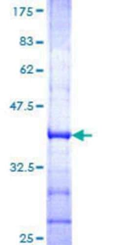 Novus Biologicals Recombinant Human GluR1 GST (N-Term) Protein 25 &mu;g | Buy Online | Novus Biologicals&trade; | Fisher Scientific