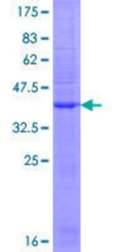 Novus Biologicals Recombinant Human Glutamate Receptor 3 GST (N-Term) Protein 25 &mu;g | Buy Online | Novus Biologicals&trade; | Fisher Scientific