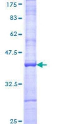 Novus Biologicals Recombinant Human Glutamate Receptor 3 GST (N-Term) Protein 25 &mu;g | Buy Online | Novus Biologicals&trade; | Fisher Scientific
