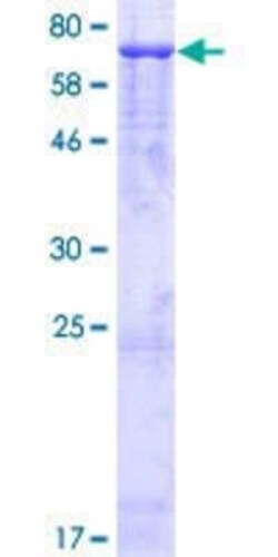 Novus Biologicals Recombinant Human Glutamate Receptor 4 GST (N-Term) Protein 2 &mu;g | Buy Online | Novus Biologicals&trade; | Fisher Scientific
