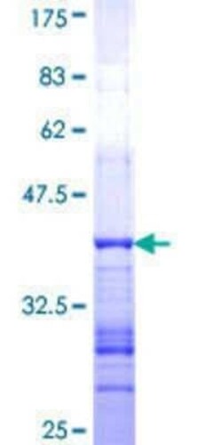 Novus Biologicals Recombinant Human GRID2 GST (N-Term) Protein 10 &mu;g | Buy Online | Novus Biologicals&trade; | Fisher Scientific