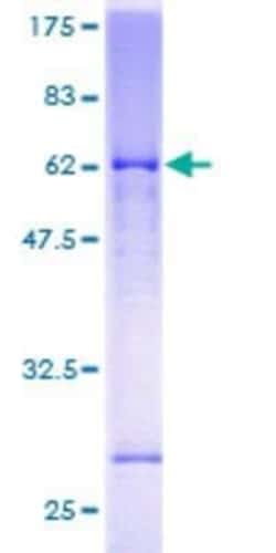 Novus Biologicals Recombinant Human Glutamate Receptor 6 GST (N-Term) Protein 25 &mu;g | Buy Online | Novus Biologicals&trade; | Fisher Scientific