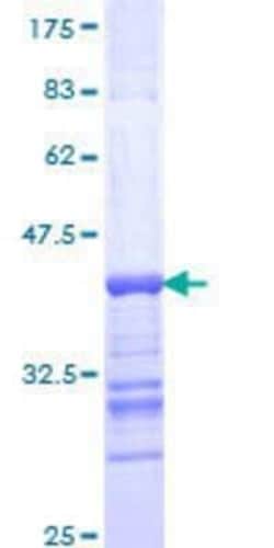 Novus Biologicals Recombinant Human KA1/GRIK4/Glutamate Receptor KA1 GST (N-Term) Protein 10 &mu;g | Buy Online | Novus Biologicals&trade; | Fisher Scientific