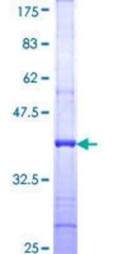 Novus Biologicals Recombinant Human NMDAR1 GST (N-Term) Protein 2 &mu;g | Buy Online | Novus Biologicals&trade; | Fisher Scientific