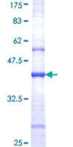 Novus Biologicals Recombinant Human NMDAR2B GST (N-Term) Protein 10 &mu;g | Buy Online | Novus Biologicals&trade; | Fisher Scientific