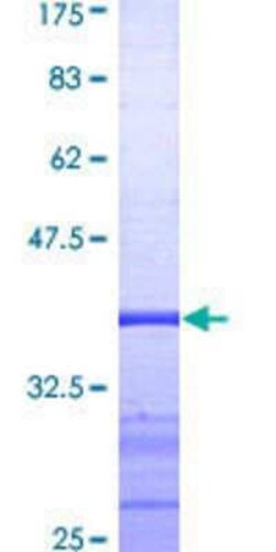 Novus Biologicals Recombinant Human GR/NR3C1 GST (N-Term) Protein 25 &mu;g | Buy Online | Novus Biologicals&trade; | Fisher Scientific