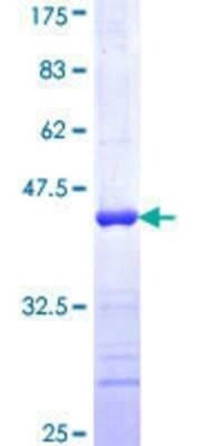 Novus Biologicals Recombinant Human GRSF1 GST (N-Term) Protein 10 &mu;g | Buy Online | Novus Biologicals&trade; | Fisher Scientific
